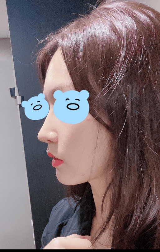 최고에요!! 수술후기 사진 3