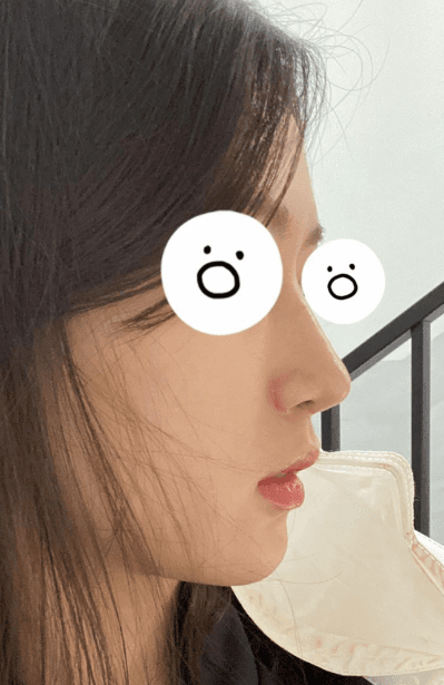 최고에요!! 수술후기 사진 2