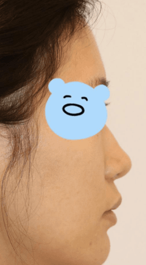 최고에요!! 수술후기 사진 4