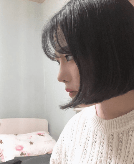 너무 이뻐요 ㅠㅠㅠ 수술후기 사진 2