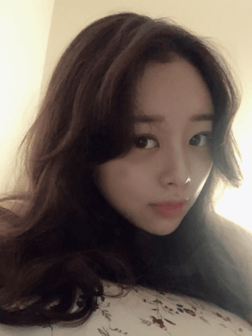 너무 마음에 듭니당♥ 수술후기 사진 2