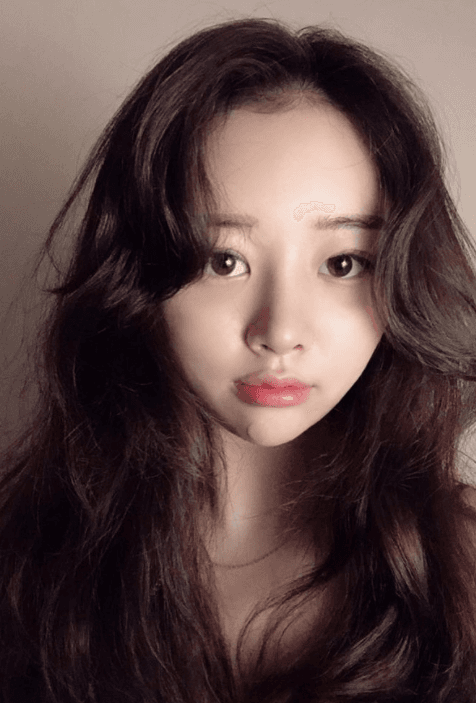너무 마음에 듭니당♥ 수술후기 사진 3