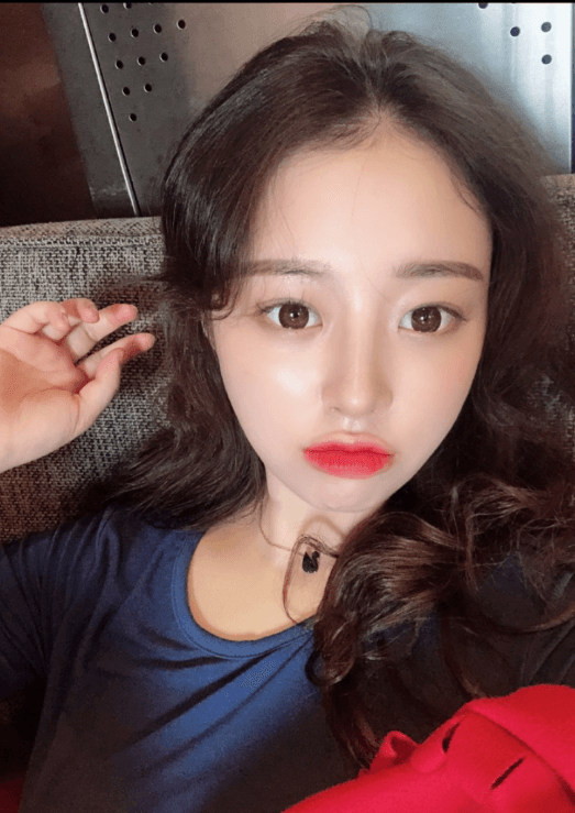 3주차 입니다ㅎㅎㅎ 수술후기 사진 2