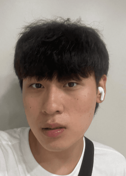 만족스러운 결과를 얻었습니다! 수술후기 사진 3