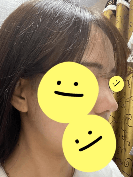너무너무 추천 합니다~!! 수술후기 사진 2
