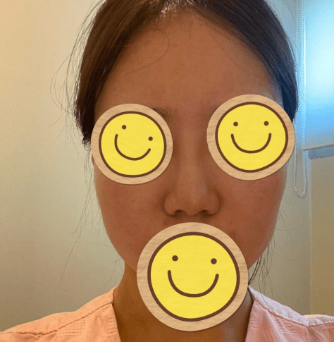 너무너무 추천 합니다~!! 수술후기 사진 3