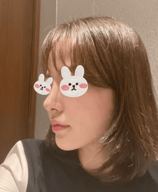 너무 예뻐용 수술후기 사진 2