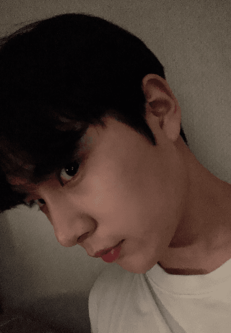 후회 절대 안하는게 너무 좋습니다 수술후기 사진 4