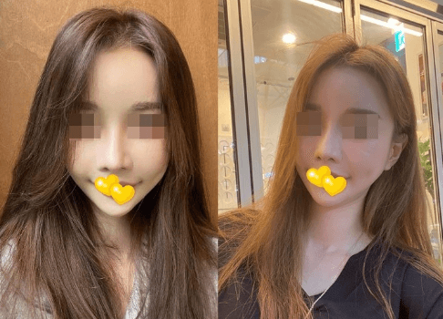 행복해 하면서 보내게 됐네요 ㅎㅎ 수술후기 사진 4