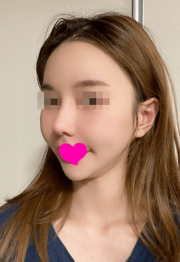행복해 하면서 보내게 됐네요 ㅎㅎ 수술후기 사진 2