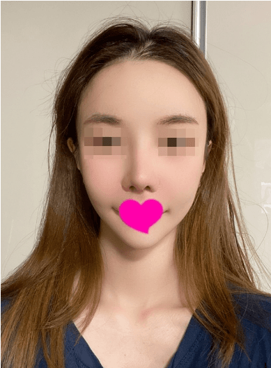 행복해 하면서 보내게 됐네요 ㅎㅎ 수술후기 사진 3