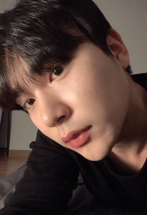 절대 고민하지마세요!!! 수술후기 사진 4
