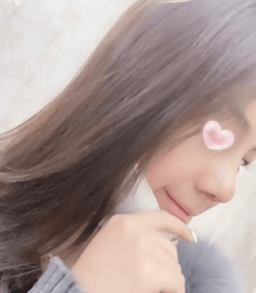 기뻐서 울뻔 했어요 ㅎㅎ 수술후기 사진 2