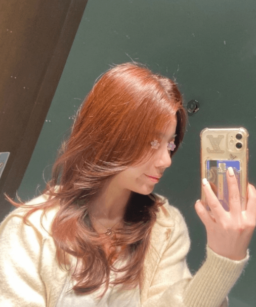 주변에서도 다들 잘됐다고 난리네요! 수술후기 사진 2