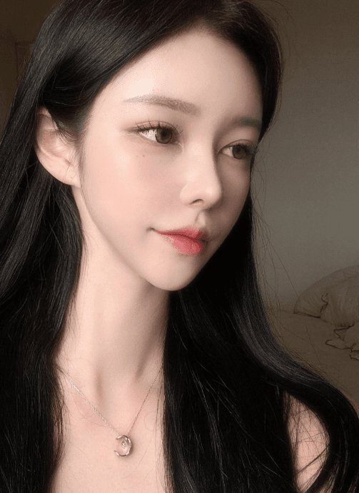 코원 원장님 ㄹㅇ 금손.. ㅠㅠㅠ 수술후기 사진 4