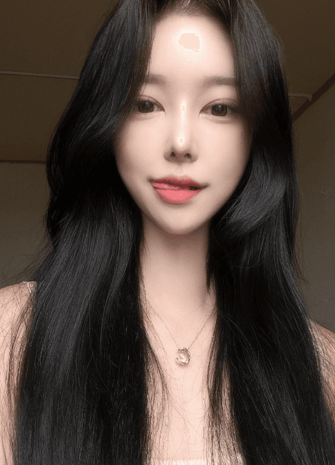 코원 원장님 ㄹㅇ 금손.. ㅠㅠㅠ 수술후기 사진 5