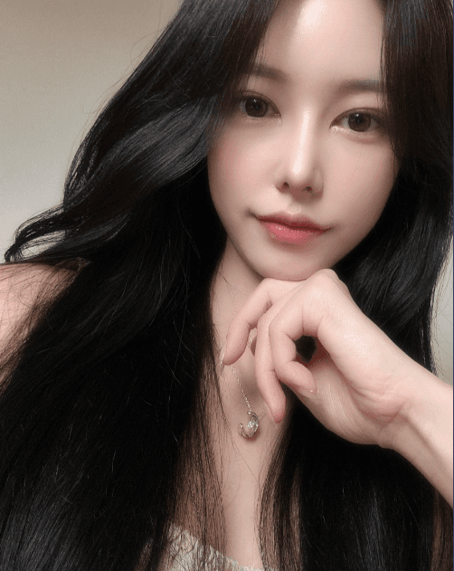 코원 원장님 ㄹㅇ 금손.. ㅠㅠㅠ 수술후기 사진 7
