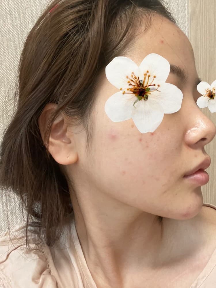 정말 만족 합니다 너무 예뻐용 수술후기 사진 6