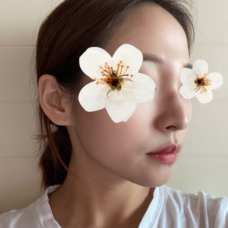 시간 지날수록 만족합니다 ㅎㅎ 수술후기 사진 2