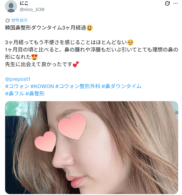 환자수술후기 — 「1ヶ月の頃と比べると理想の鼻の形に」鼻整形3ヶ月