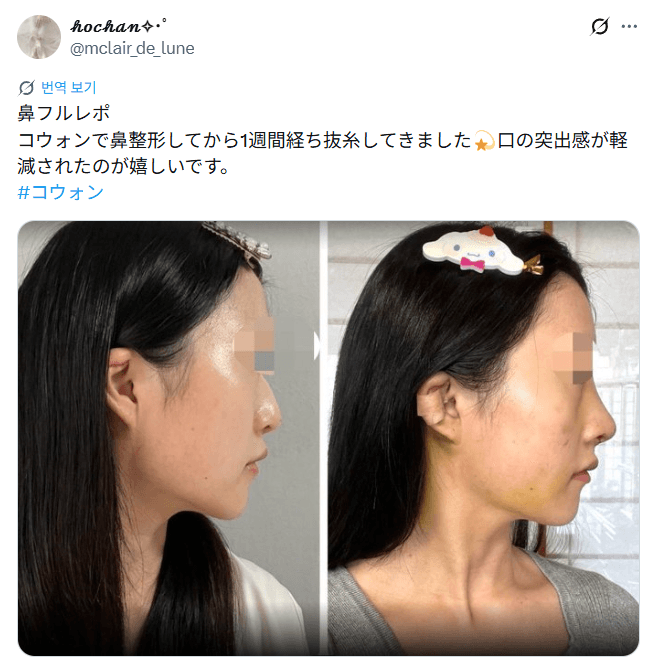 설명