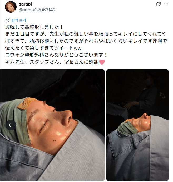 รีวิวหลังผ่าตัดของผู้ป่วย — 「難しい鼻をキレイにしてくれて嬉しすぎ」鼻整形当日
