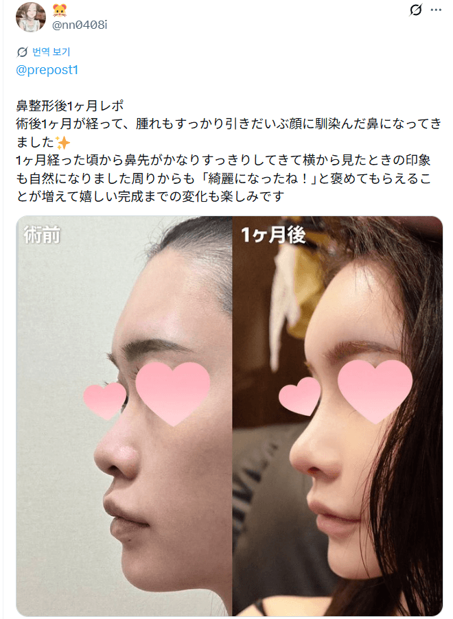 설명