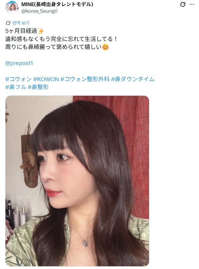 รีวิวหลังผ่าตัดของผู้ป่วย — 「違和感もなくもう完全に忘れて生活してる！」鼻整形5ヶ月