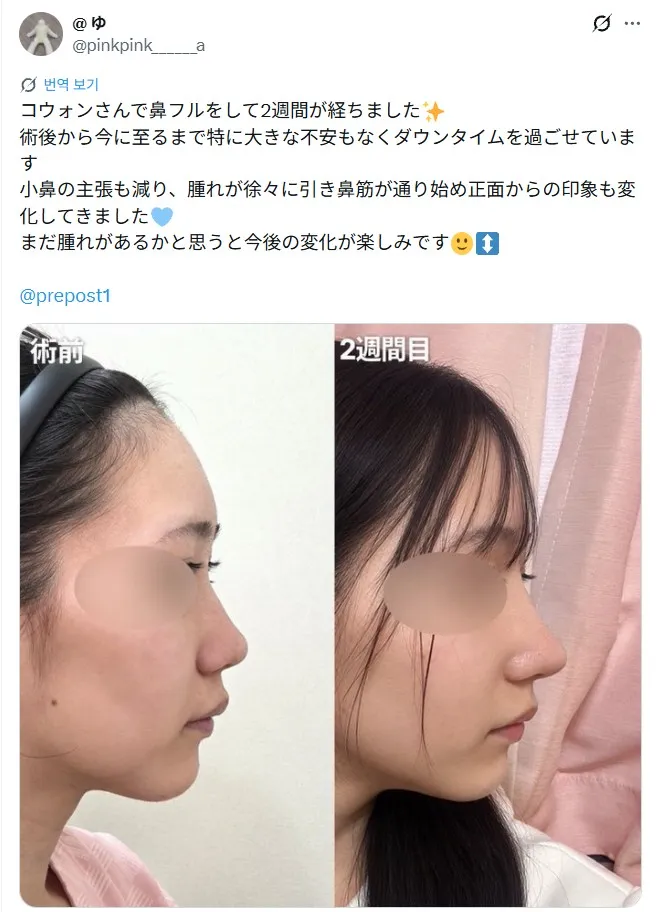 설명