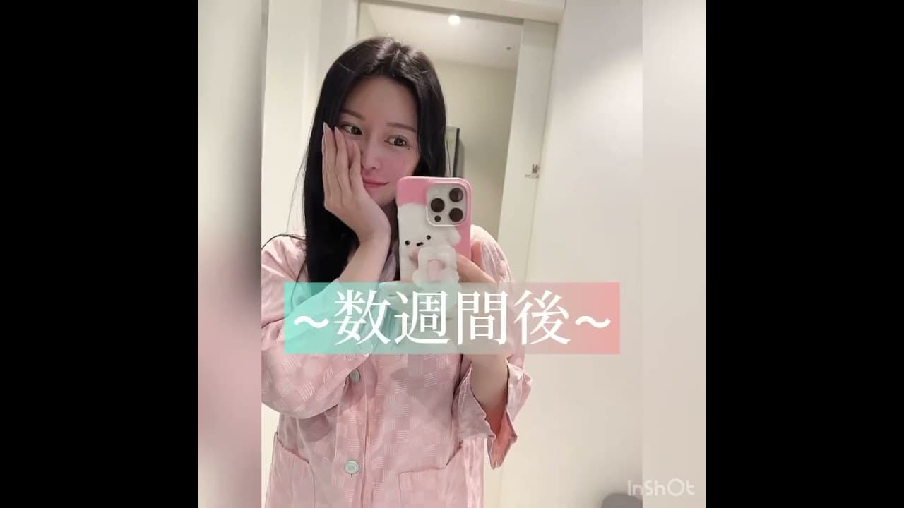 鼻中隔湾曲症を治してもらったよ👃