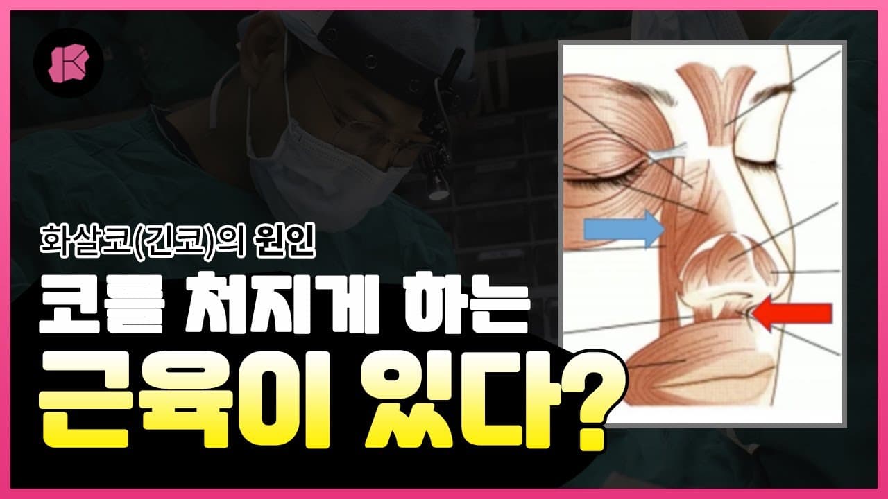 화살코를 만드는 근육이 있다구요? | 처진코, 코처짐의 원인