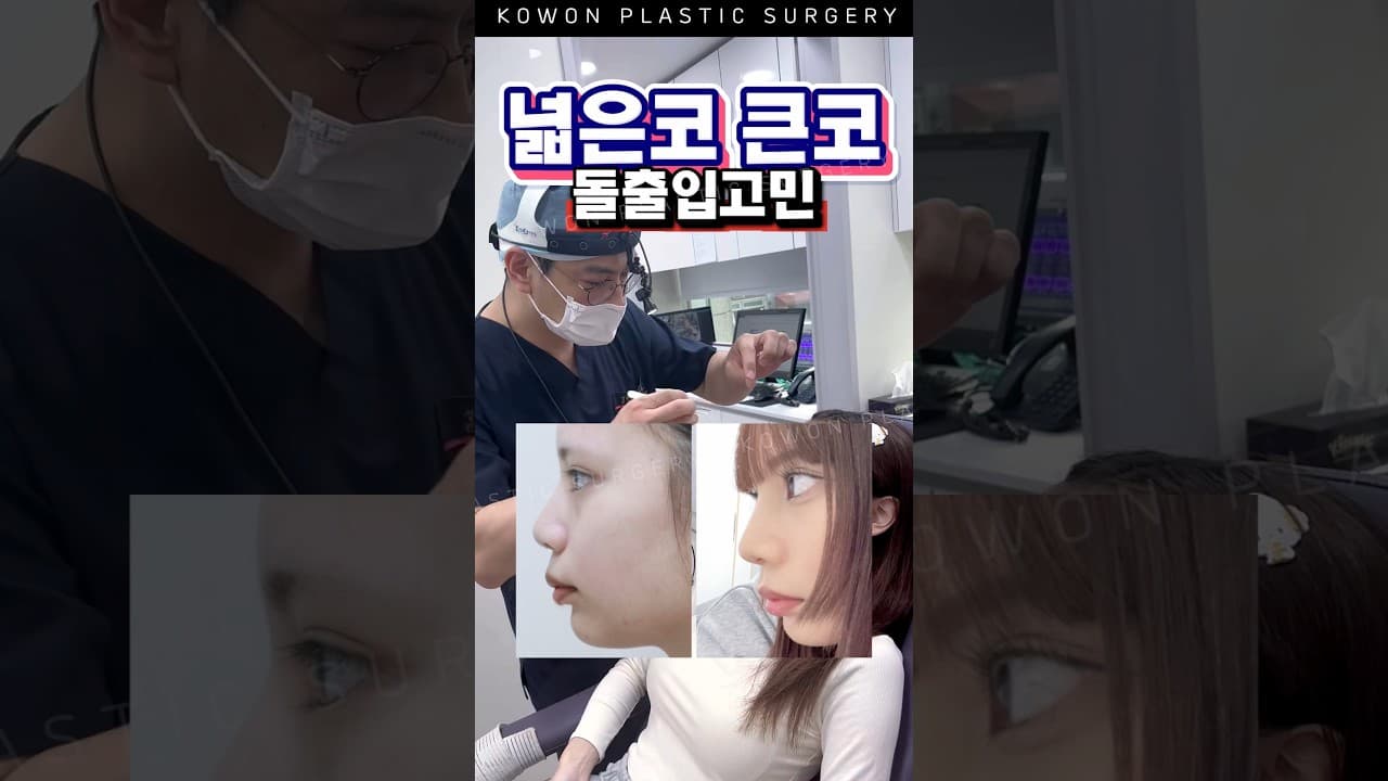 코수술했더니 입매까지 교정돼버림 #코원성형외과 #코원 #kowon #KOWON PLASTIC SURGERY #복코수술 #넓은코 #돌출입