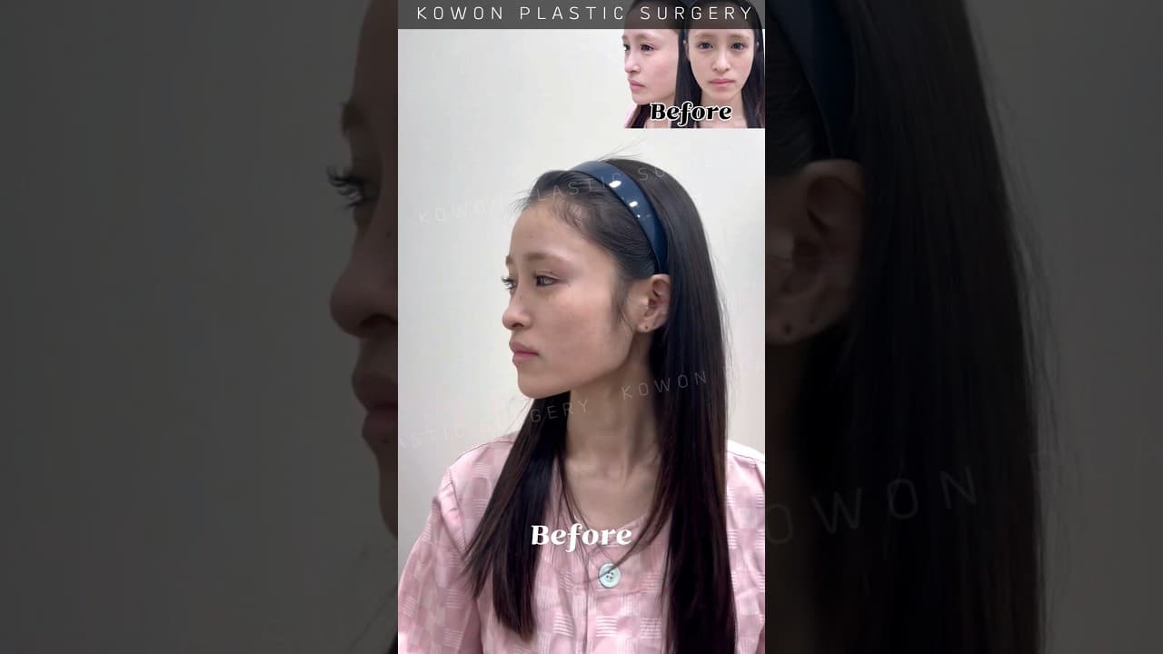 화살코 느낌, 이렇게까지 정리된다고?