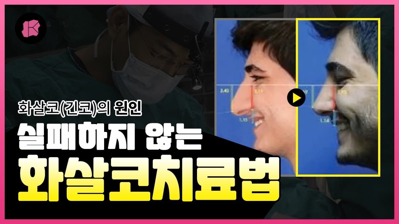 화살코 교정 실패하지 않는 법! 알기 쉽게 설명해드립니다👃