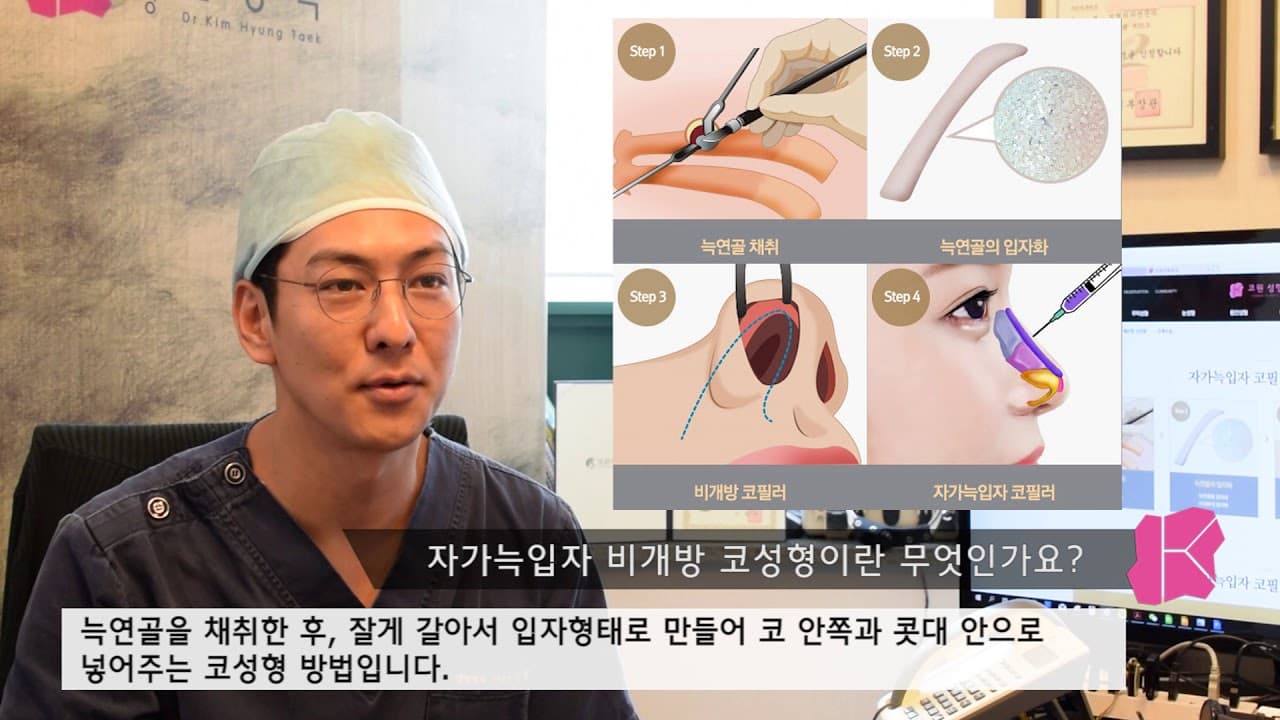 자가늑입자 비개방 코성형이란 무엇일까요?