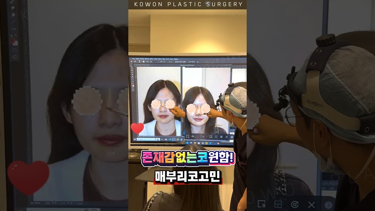 매부리코고민 존재감없는코원함