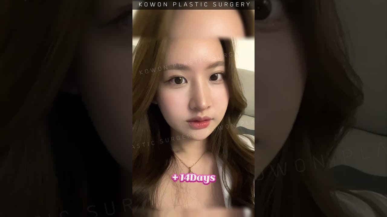 낮은코 자려한코라인으로 가능한가요?