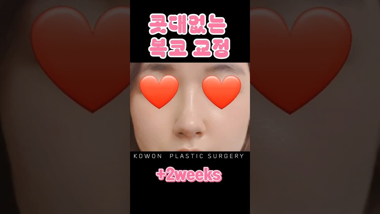 코원 복코 후기 | 콧대 하나도 없는 전형적인 복코가 고민