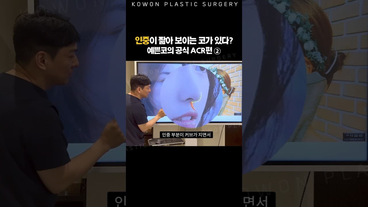 인중 길어서 고민이라고? 코랑도 관련있음