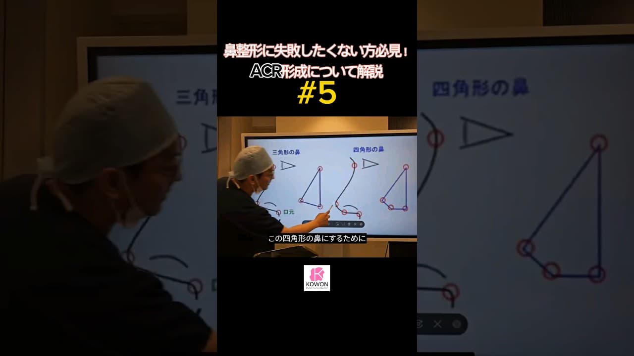 Part.5 鼻整形に失敗したくない方必見！鼻整形の仕上がりを左右するACR形成について解説