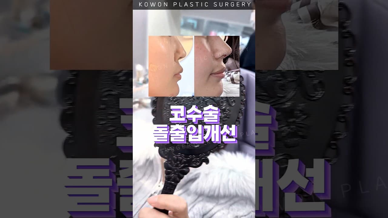 돌출입 고민인데 코수술했다고?
