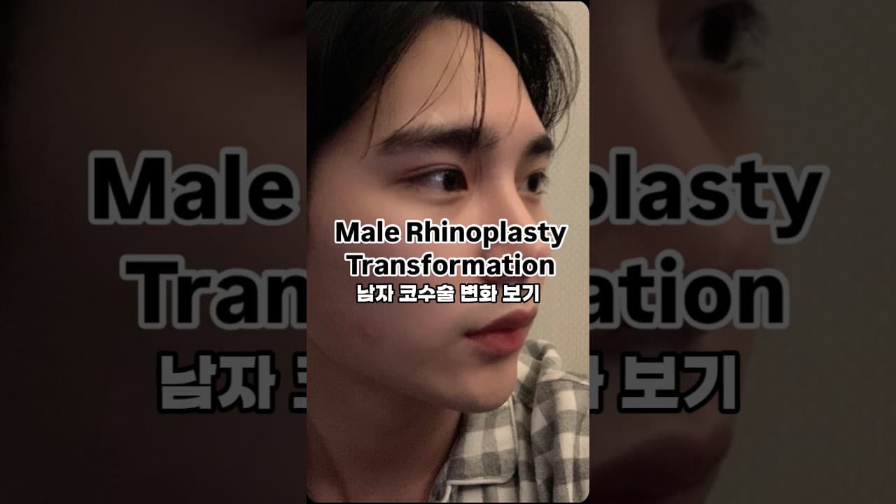 ✨ 남자 매부리코 낮은 코끝 달라질 수 있어요! ✨