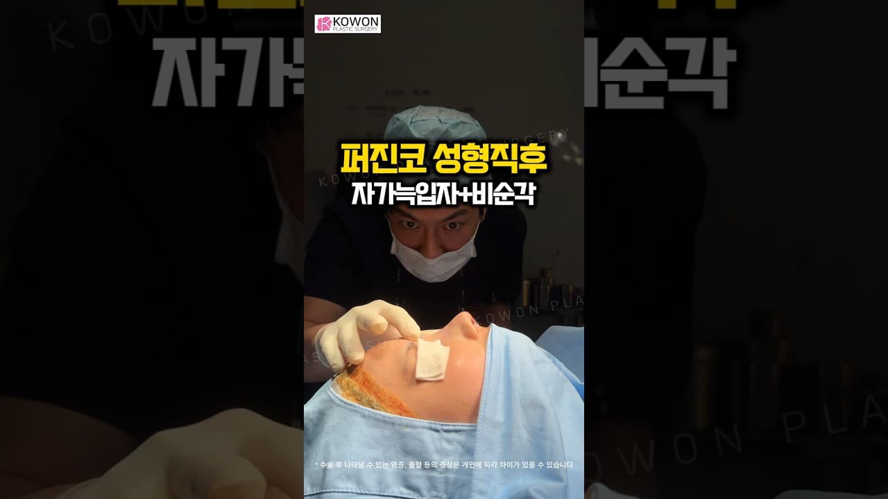 정면에서 콧구멍 보이는 사람 필수 시청" 넓고 뭉뚝한 퍼진 코, 자가늑입자와 '이 수술'로 싹 바뀐 직후 라인!