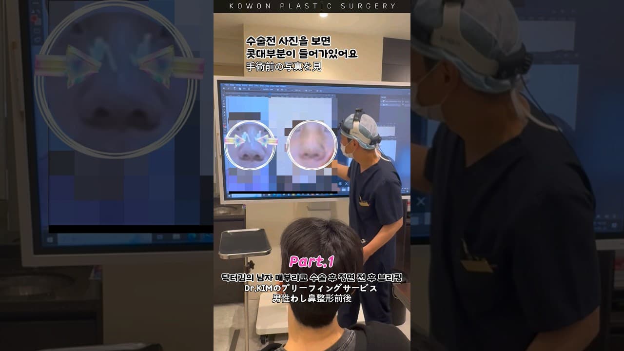 Part.1 코원 닥터김의 남자 매부리코 교정 전 후 브리핑