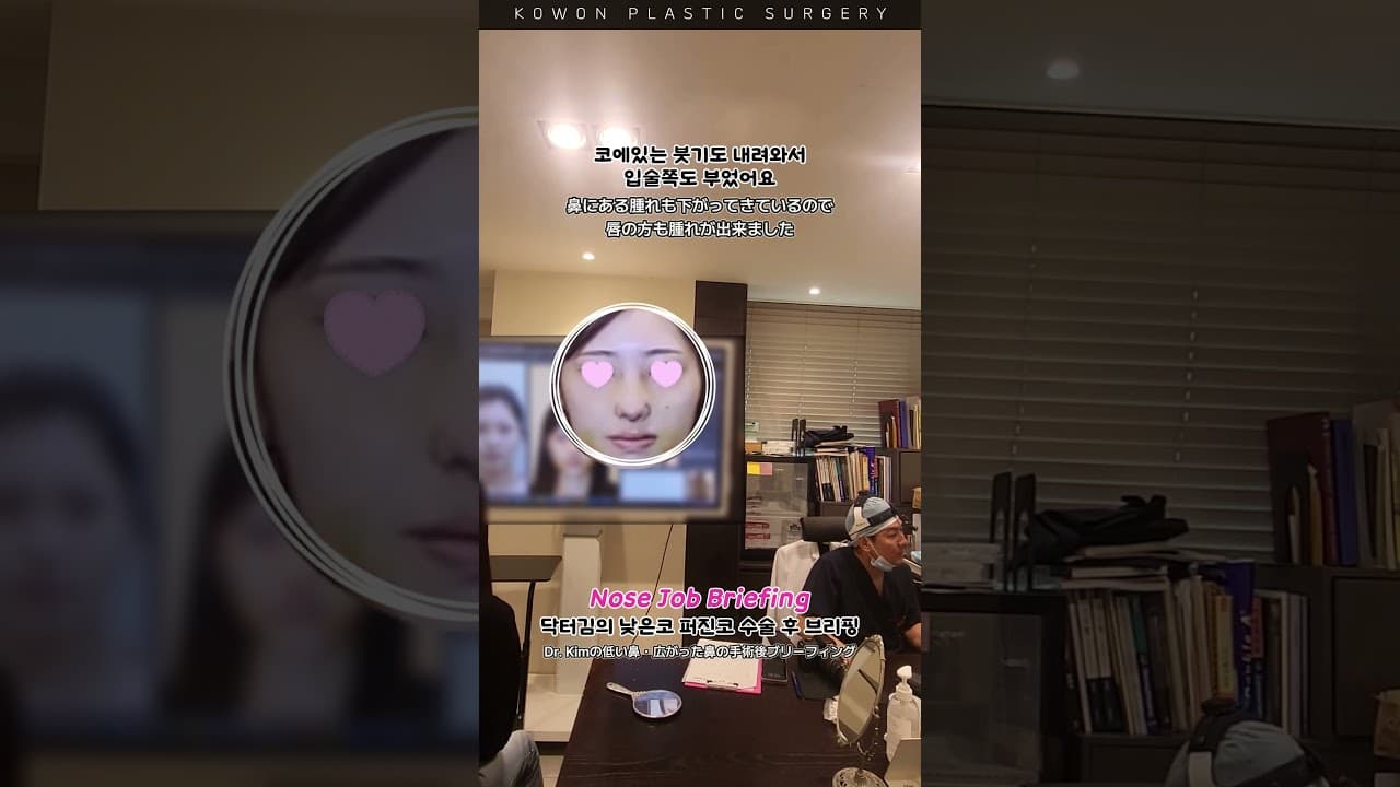Part.1_낮은코 퍼진코 수술 후 브리핑 (경과 중 붓기 설명편)