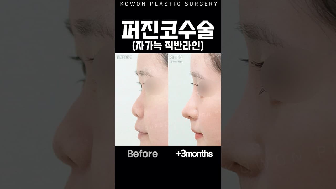 코끝이 눌려보여 고민이라고?