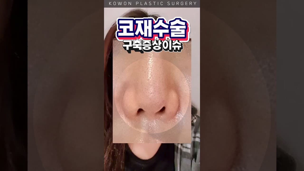 코가 휘고 들리기시작해서 결국....😭😭