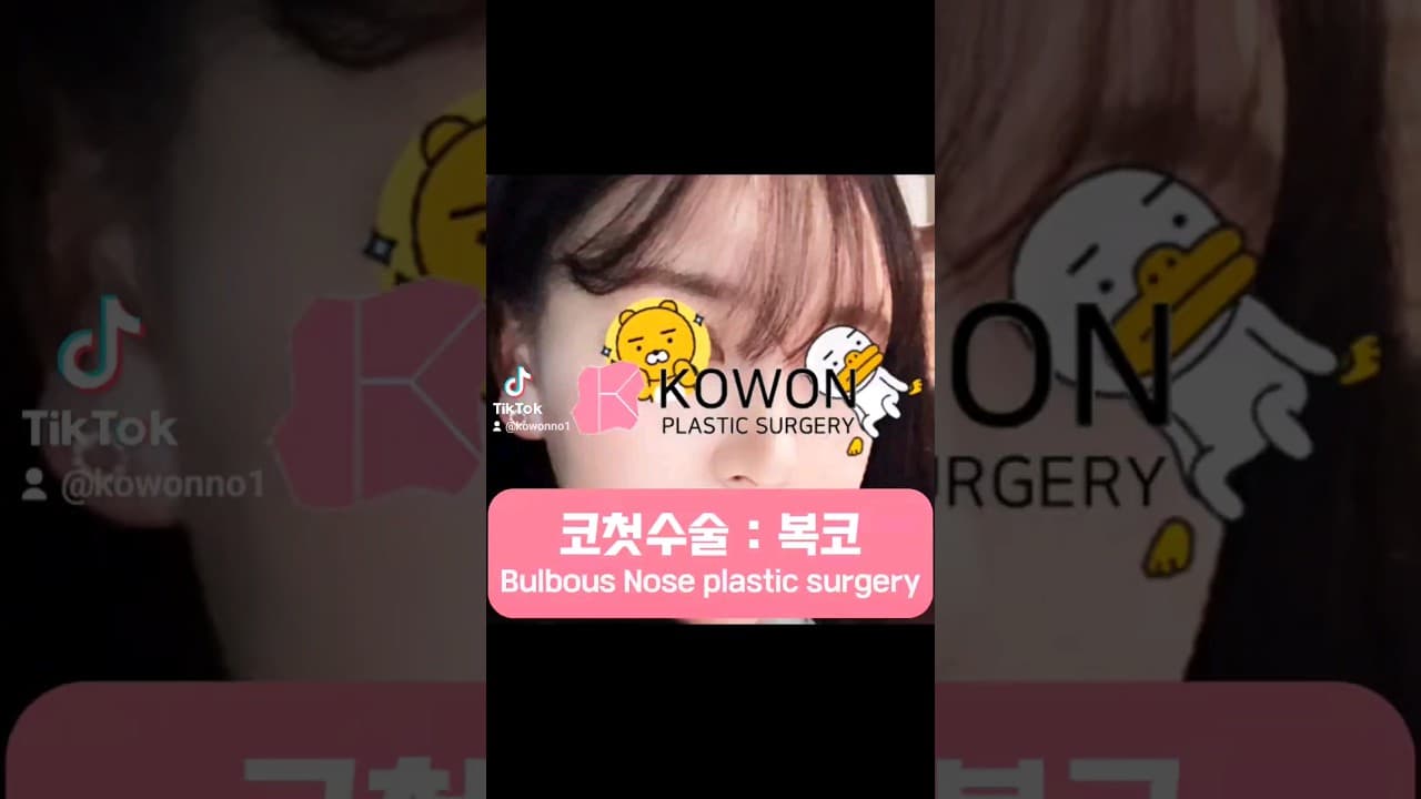 [KOWON] 코첫수술 : 복코수술 (My first Nose Job! Bulbous Nose plastic surgery)