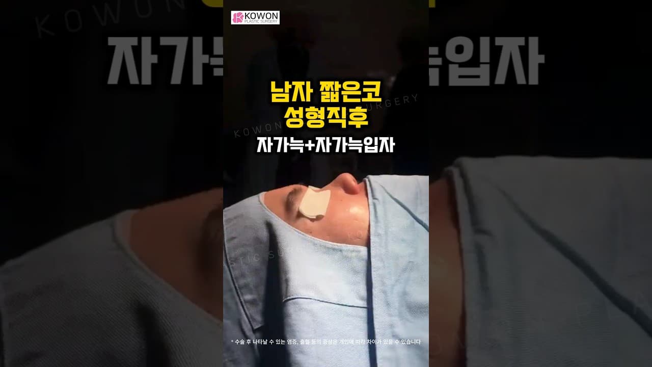 코가 짧고 낮다고? 남자 코성형 직후