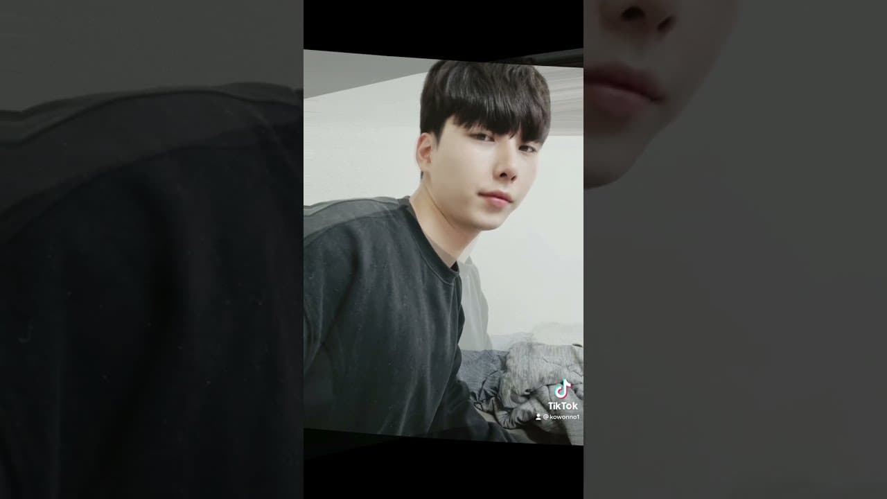코원성형외과 코 성형 ★Before & After★